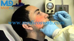 يمكن أن تساعد مسحة الأنف في تشخيص سرطان الرئة