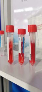 L'épidémie américaine est hors de contrôle