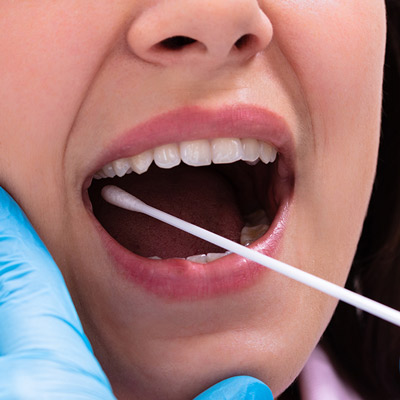 Cheek Swab Testing