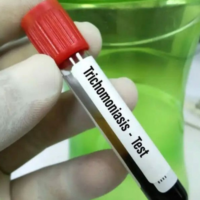 Trichomoniasis Testing